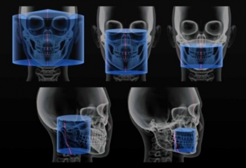 Dimax-Ray: Cone beam computed tomography